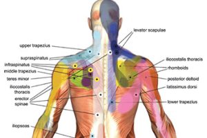 Trigger Point Massage Therapy in Highlands Ranch CO